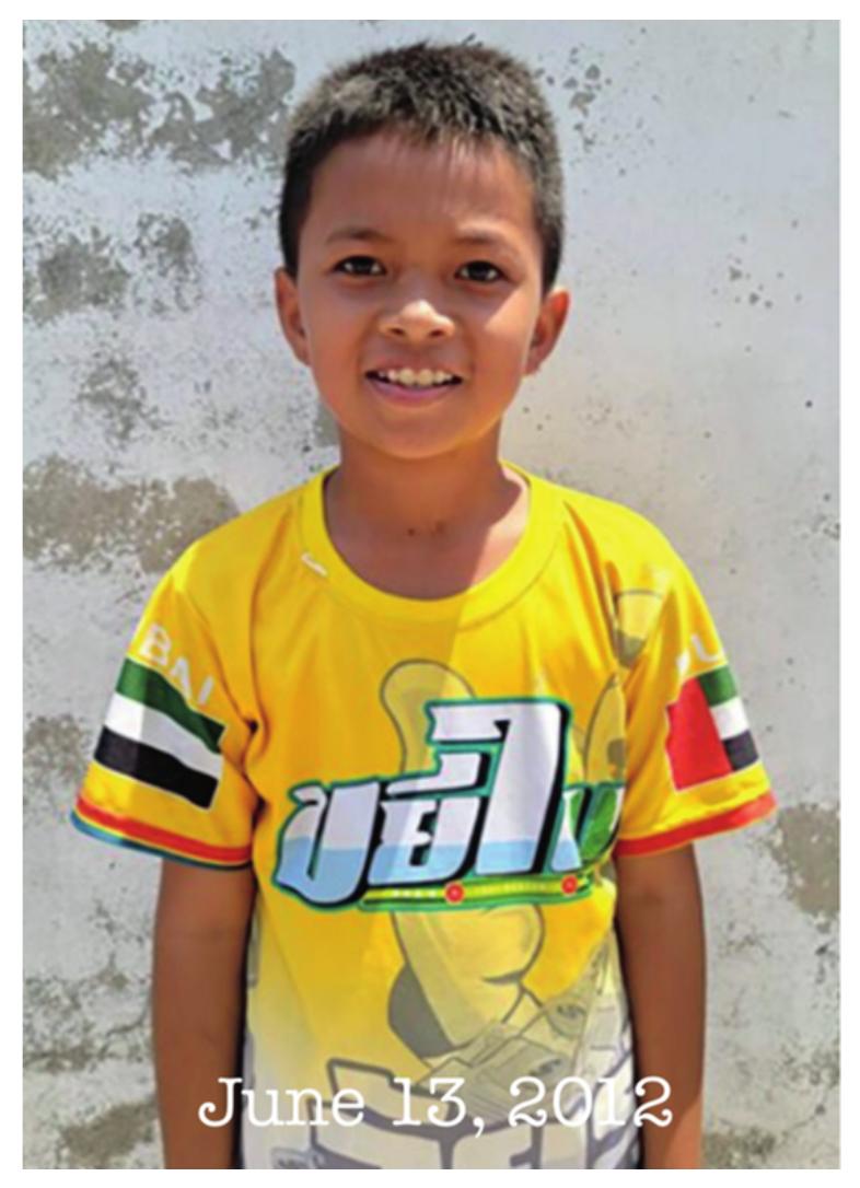 Thilong Ros — sponsorship photo